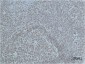PARP1 (10C2) Mouse mAb ABZ4220