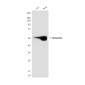 Vimentin (10E2) Mouse mAb ABZ4221