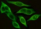 ICAM1 (4F5) Mouse mAb ABZ4237