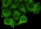 Cytokeratin 18 (2B5) Mouse mAb ABZ4238