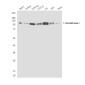 Hexokinase I Mouse mAb ABZ4239
