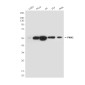 PKM2 (1A7) Mouse mAb ABZ4243