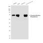 Placental Alkaline Phosphatase Mouse mAb ABZ4245