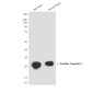 Cardiac Troponin I (1D7) Mouse mAb ABZ4252