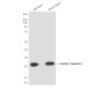 Cardiac Troponin I (2D10) Mouse mAb ABZ4253