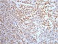 NSE Mouse mAb ABZ4258