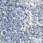 FH/Fumarase Mouse mAb ABZ4259