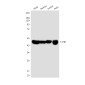FH/Fumarase Mouse mAb ABZ4259