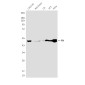FH/Fumarase Mouse mAb ABZ4260