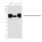Placental Alkaline Phosphatase Mouse mAb ABZ4263