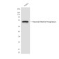 Placental Alkaline Phosphatase Mouse mAb ABZ4263