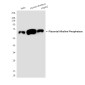Placental Alkaline Phosphatase Mouse mAb ABZ4263