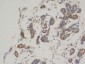 Bcl 2 (3H5) Mouse mAb ABZ4271