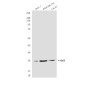 Bcl 2 (3H5) Mouse mAb ABZ4271