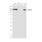 SMC1A Mouse mAb ABZ4273