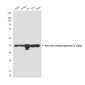 Pyruvate Dehydrogenase E1 alpha Mouse mAb ABZ4274
