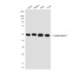 Cytokeratin 7 Mouse mAb ABZ4275