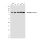 EEF2/Elongation factor 2 Mouse mAb ABZ4283