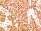 Acetyl-NF-KB p65 (Lys314/Lys315) (6D6) Mouse mAb ABZ4312