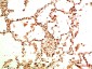 Acetyl-NF-KB p65 (Lys314/Lys315) (6D6) Mouse mAb ABZ4312