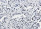 Acetyl-Histone H3 (Lys27) Rabbit mAb ABZ4314