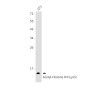 Acetyl-Histone H4 (Lys5) Rabbit mAb ABZ4320