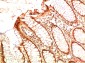 Acetyl-p53 (Lys382) (7E1) Mouse mAb ABZ4321