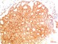 Acetyl-p53 (Lys382) (3E3) Mouse mAb ABZ4324