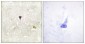 Phospho-ALK (Tyr1604) Rabbit pAb ABZ4342