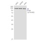 Phospho-PERK (Thr982) Rabbit pAb ABZ4345