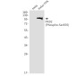Phospho-PRKD2 (Ser876) Rabbit mAb ABZ4346