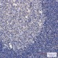 Phospho-TAOK1/2/3 (Ser181/Ser181/Ser177) Rabbit mAb ABZ4350