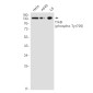 Phospho-TrkB (Tyr705) Rabbit mAb ABZ4351