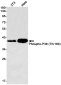Phospho-p38 MAPK (Thr180) Rabbit mAb ABZ4354