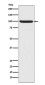 Phospho-NRF2 (Ser40) Rabbit mAb ABZ4356