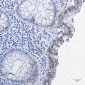Phospho-Smad2 (Ser255) Rabbit mAb ABZ4358