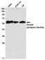 Phospho-Smad2 (Ser250) Rabbit mAb ABZ4359