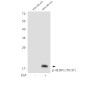 Phospho-4E BP1 (Thr37) Rabbit pAb ABZ4367