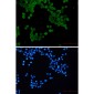 Phospho-AMPK alpha 1 (Ser496) Rabbit mAb ABZ4368