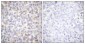 Phospho-AMPK alpha 1/2 (Thr183/Thr172) Rabbit pAb ABZ4369