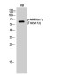 Phospho-AMPK alpha 1/2 (Thr183/Thr172) Rabbit pAb ABZ4369