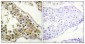 Phospho-ITK (Tyr512) Rabbit pAb ABZ4371