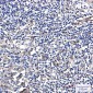 Phospho-PKC delta (Ser299) Rabbit mAb ABZ4372