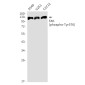 Phospho-FAK (Tyr576) Rabbit mAb ABZ4374