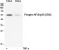 Phospho-NF-KB p65 (Ser536) Rabbit pAb ABZ4375