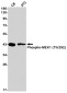 Phospho-MEK1 (Thr292) Rabbit mAb ABZ4377