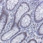 Phospho-MDM2 (Ser166) Rabbit mAb ABZ4379