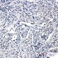 Phospho-Histone H3 (Ser10/Thr11) Rabbit mAb ABZ4386