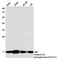 Phospho-Histone H3 (Ser10/Thr11) Rabbit mAb ABZ4386