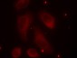 Phospho-LIM Kinase 1 (Thr508) Rabbit pAb ABZ4389